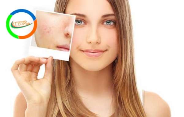 Best Skin Care Tips For Women| 100% Natural Ingredients|Lavish Grace Cream!